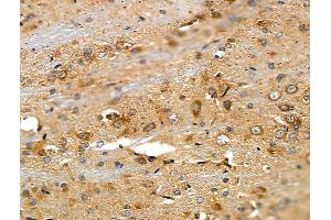 ABIN6257883 and ABIN6275262 at 1/100 staining Rat brain tissue by IHC-P.