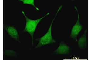 Immunofluorescence of monoclonal antibody to FBXW4P1 on HeLa cell. (FBXW4P1 antibody  (AA 31-130))