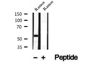 Western blot analysis of extracts of Ramos cells, using Phospho-CD79A (Tyr182) Antibody. (CD79a antibody  (pTyr182))