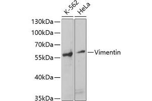 Western blot analysis of extracts of various cell lines, using Vimentin antibody (ABIN3016291, ABIN3016292, ABIN3016293 and ABIN6219693) at 1:1000 dilution. (Vimentin antibody  (AA 1-200))
