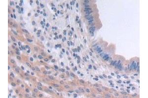 Detection of TSK in Mouse Uterus Tissue using Polyclonal Antibody to Tsukushin (TSK) (TSKU antibody  (AA 30-307))