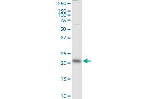 RAB13 monoclonal antibody (M01), clone 8H8. (RAB13 antibody  (AA 1-203))