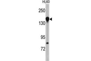 Western blot analysis of NUP155 antibody (N-term) in HL60 cell line lysates (35ug/lane). (NUP155 antibody  (N-Term))