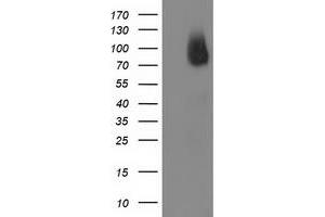 HEK293T cells were transfected with the pCMV6-ENTRY control (Left lane) or pCMV6-ENTRY BCAR1 (Right lane) cDNA for 48 hrs and lysed. (BCAR1 antibody)