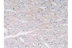 Detection of CCK in Rat Heart Tissue using Polyclonal Antibody to Cholecystokinin (CCK) (Cholecystokinin antibody  (AA 1-115))