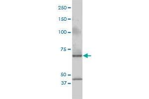 CSTF2 monoclonal antibody (M01), clone 3D1-3A6 Western Blot analysis of CSTF2 expression in Jurkat . (CSTF2 antibody  (AA 1-577))