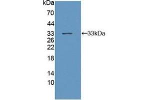 Detection of Recombinant gp130, Mouse using Polyclonal Antibody to Glycoprotein 130 (gp130) (CD130/gp130 antibody  (AA 238-500))