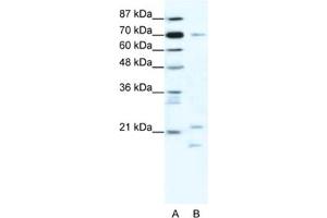Western Blotting (WB) image for anti-Basic Transcription Factor 3 (BTF3) antibody (ABIN2461626) (BTF3 antibody)