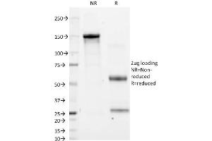 SDS-PAGE Analysis Purified CD11a Mouse Monoclonal Antibody (CRIS-3). (ITGAL antibody)