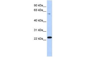 Western Blotting (WB) image for anti-Zinc Finger Protein 460 (ZNF460) antibody (ABIN2459428) (ZNF460 antibody)