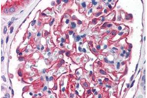 Human Kidney (formalin-fixed, paraffin-embedded) stained with ENPEP antibody ABIN351480 at 3. (ENPEP antibody  (AA 805-818))