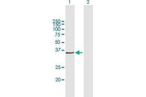 Western Blot analysis of CCND1 expression in transfected 293T cell line by CCND1 MaxPab polyclonal antibody. (Cyclin D1 antibody  (AA 1-295))