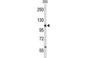 Western Blotting (WB) image for anti-Integrin, alpha 6 (ITGA6) antibody (ABIN3004102) (ITGA6 antibody)