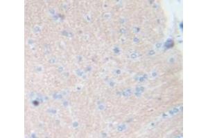 #VALUE! (Tachykinin 3 antibody  (AA 29-102))