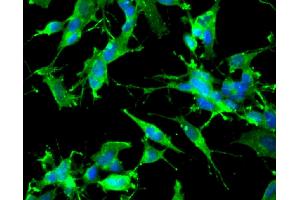 Immunofluorescent staining of undifferentiated (left) and differentiated (right) SH-SY5Y cells (ATCC CRL-2266, Human neuroblastoma). (TRKB antibody  (AA 156-322))