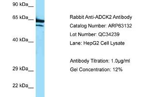 Western Blotting (WB) image for anti-AarF Domain Containing Kinase 2 (ADCK2) (C-Term) antibody (ABIN970062) (ADCK2 antibody  (C-Term))