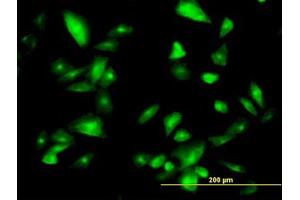 Image no. 2 for anti-Formiminotransferase Cyclodeaminase (FTCD) (AA 440-542) antibody (ABIN599156) (FTCD antibody  (AA 440-542))