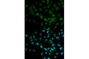 Immunofluorescence analysis of MCF7 cell using MAPK7 antibody. (MAPK7 antibody  (AA 1-310))