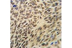 Immunohistochemistry (IHC) image for anti-X-Ray Repair Complementing Defective Repair in Chinese Hamster Cells 6 (XRCC6) (AA 521-548) antibody (ABIN3029655)