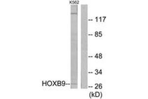 Western blot analysis of extracts from K562 cells, using HOXB9 Antibody. (HOXB9 antibody  (AA 201-250))