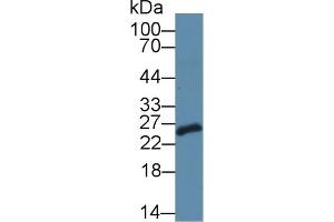 Detection of SDF2L1 in Mouse Testis lysate using Polyclonal Antibody to Stromal Cell Derived Factor 2 Like Protein 1 (SDF2L1) (SDF2L1 antibody  (AA 29-213))