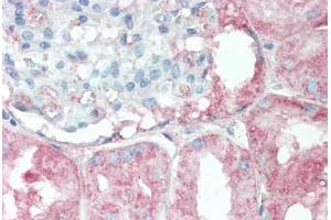 Human Kidney: Formalin-Fixed, Paraffin-Embedded (FFPE) (RPS6KC1 antibody  (AA 231-280))