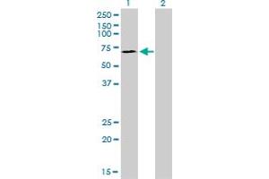 Western Blotting (WB) image for anti-SP110 Nuclear Body Protein (SP110) (AA 271-380) antibody (ABIN561432)