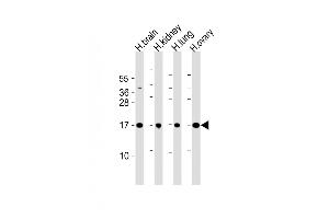 All lanes : Anti-IAL4A Antibody (Center) at 1:2000 dilution Lane 1: human brain lysate Lane 2: human kidney lysate Lane 3: human lung lysate Lane 4: human ovary lysate Lysates/proteins at 20 μg per lane. (PPIAL4A antibody  (AA 66-92))