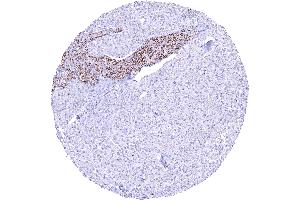 anti-Succinate Dehydrogenase Complex, Subunit A, Flavoprotein (Fp) (SDHA) (N-Term) antibody