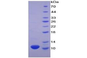 SDS-PAGE of Protein Standard from the Kit (Highly purified E. (CXCL7 ELISA Kit)