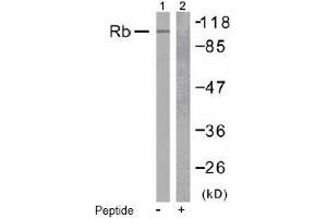 Image no. 2 for anti-Retinoblastoma 1 (RB1) (Ser807) antibody (ABIN197283) (Retinoblastoma 1 antibody  (Ser807))