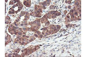 Image no. 3 for anti-phosphofructokinase, Platelet (PFKP) antibody (ABIN1500161) (PFKP antibody)