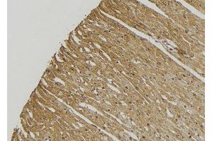 ABIN6272869 at 1/100 staining Mouse muscle tissue by IHC-P.