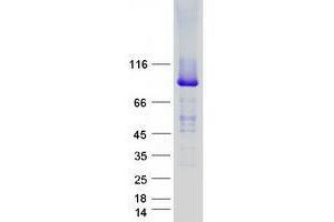 Validation with Western Blot