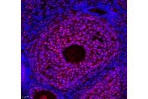Immunofluorescence of paraffin embedded mouse ovary using ZC3H11A (ABIN7076255) at dilution of 1: 650 (400x lens) (ZC3H11A antibody)