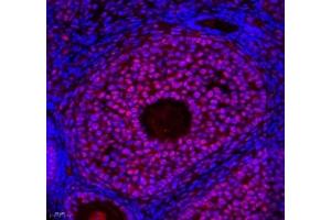 Immunofluorescence of paraffin embedded mouse ovary using ZC3H11A (ABIN7076255) at dilution of 1: 650 (400x lens)
