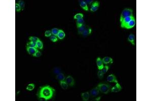 Immunofluorescence staining of PC-3 cells with ABIN7153483 at 1:33, counter-stained with DAPI.
