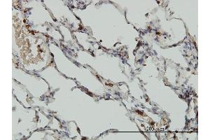 Immunoperoxidase of monoclonal antibody to CORO1A on formalin-fixed paraffin-embedded human lung. (Coronin 1a antibody  (AA 360-461))