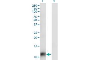 Western Blot analysis of SNAPC5 expression in transfected 293T cell line by SNAPC5 monoclonal antibody (M02), clone 5C3. (SNAPC5 antibody  (AA 1-68))