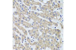 Immunohistochemistry of paraffin-embedded human liver injury using ACP1 antibody (ABIN5975334) at dilution of 1/100 (40x lens).