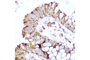 Immunohistochemistry of paraffin-embedded human colon using NOD2 Rabbit pAb (ABIN7269065) at dilution of 1:100 (40x lens).