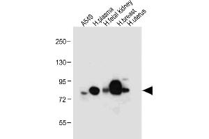 Western Blotting (WB) image for anti-Lactotransferrin (LTF) antibody (ABIN652643)