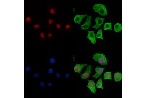 ABIN6266074 and ABIN6269267 staining HepG2 cells by IF/ICC.