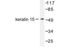Image no. 1 for anti-Keratin 15 (KRT15) antibody (ABIN265494)