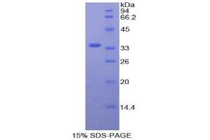 SDS-PAGE analysis of General SPA Protein. (Surfactant Protein A1 Protein (SFTPA1))