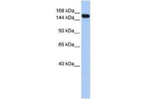 WB Suggested Anti-UBE3A Antibody Titration:  0. (ube3a antibody  (Middle Region))