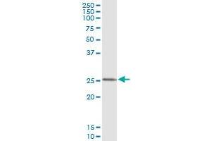 Immunoprecipitation of FXN transfected lysate using anti-FXN monoclonal antibody and Protein A Magnetic Bead , and immunoblotted with FXN MaxPab rabbit polyclonal antibody. (Frataxin antibody  (AA 91-200))