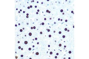 Immunohistochemistry (IHC) image for anti-Heterogeneous Nuclear Ribonucleoprotein U (Scaffold Attachment Factor A) (HNRNPU) antibody (ABIN1679689)