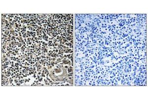 Immunohistochemistry analysis of paraffin-embedded human thymus gland tissue using CBLN4 antibody. (CBLN4 antibody  (C-Term))