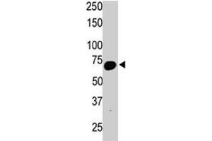 The SYVN1 polyclonal antibody  is used in Western blot to detect SYVN1 in mouse kidney tissue lysate.